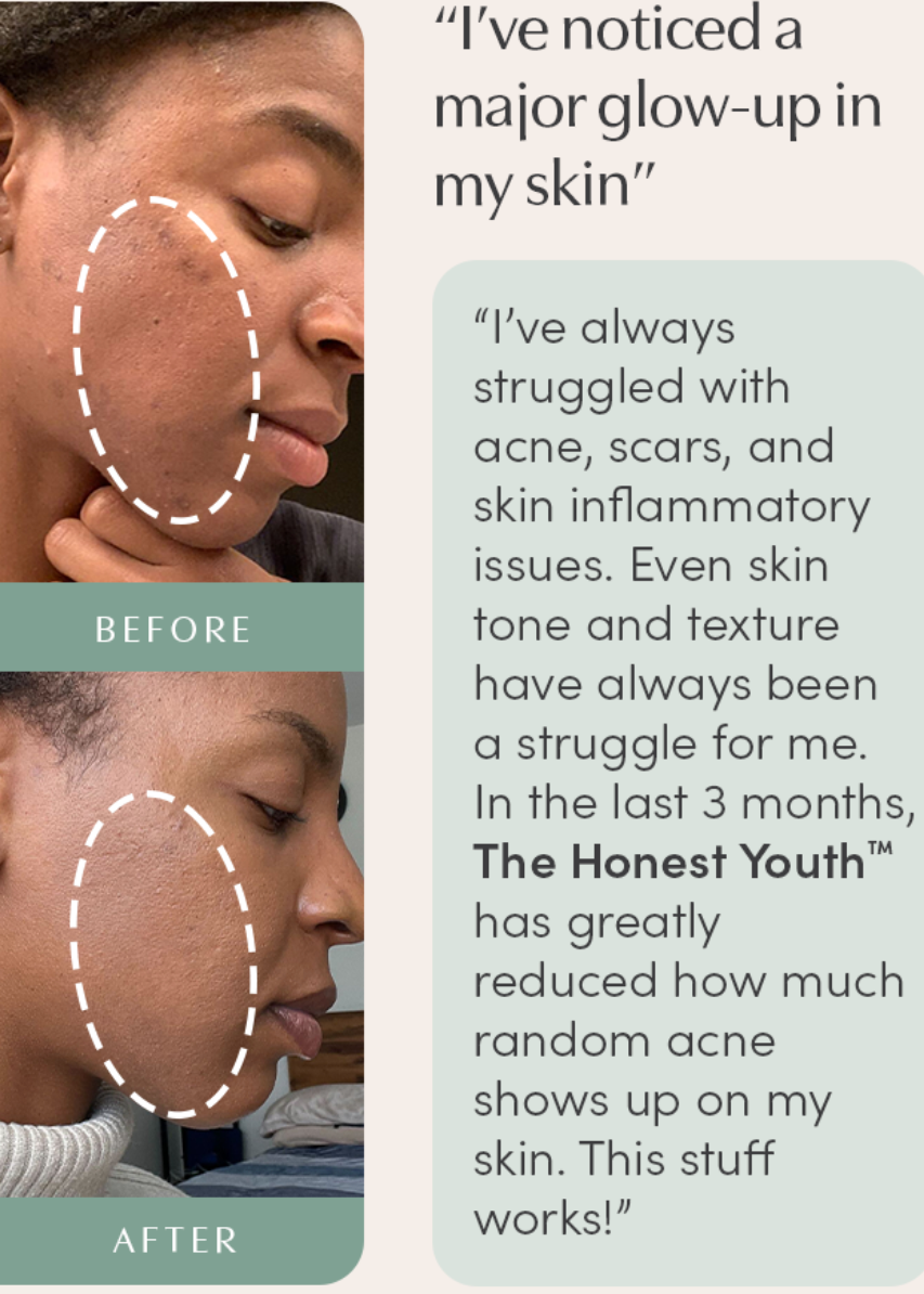 The Honest Youth™ - skin & anti-aging ingestible tincture
