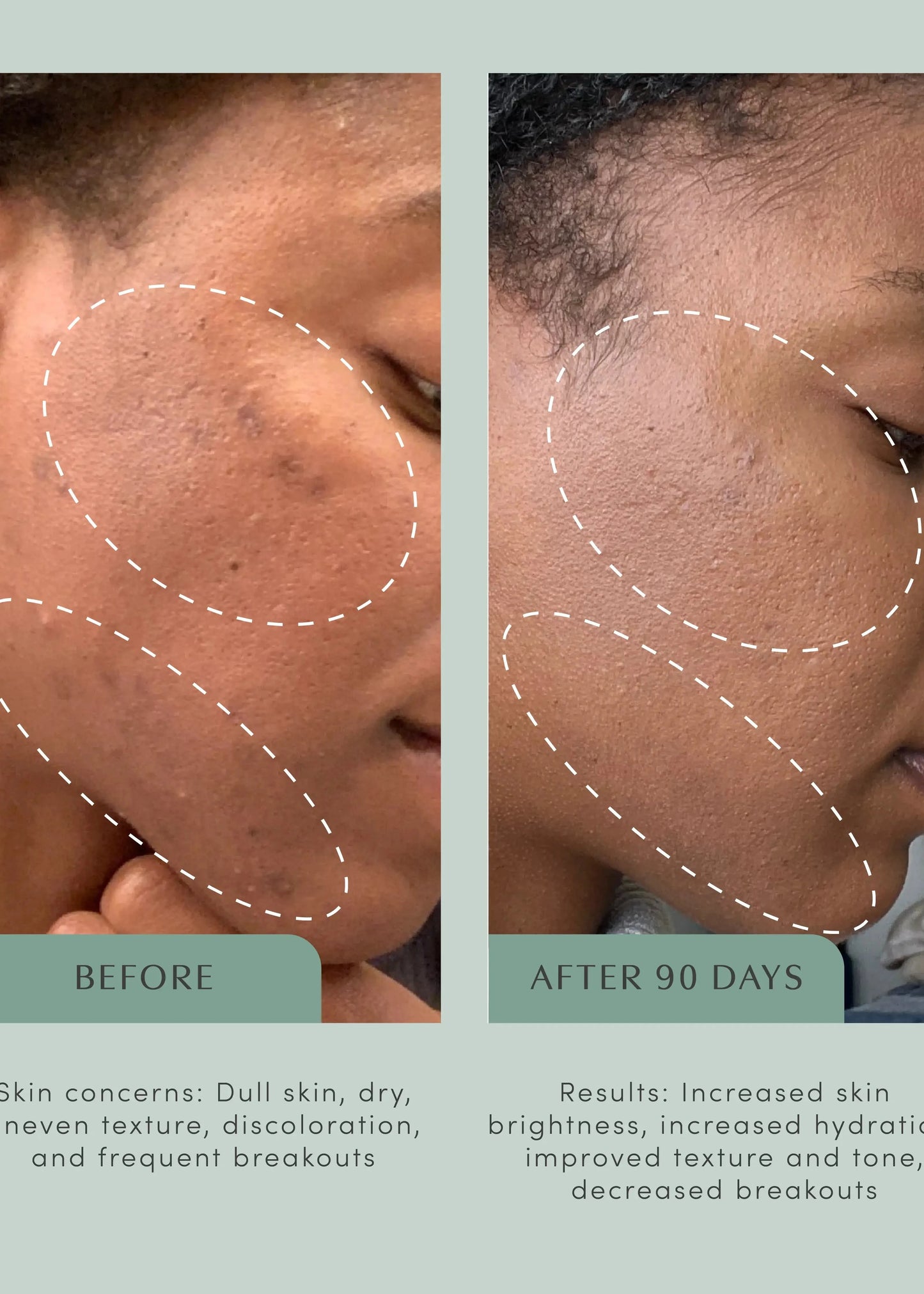 The Honest Youth™ - skin & anti-aging ingestible tincture